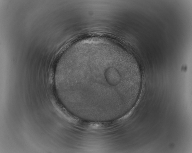 X0000115090174200911171225