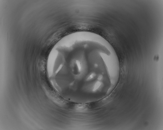 X0000115090175200911171225