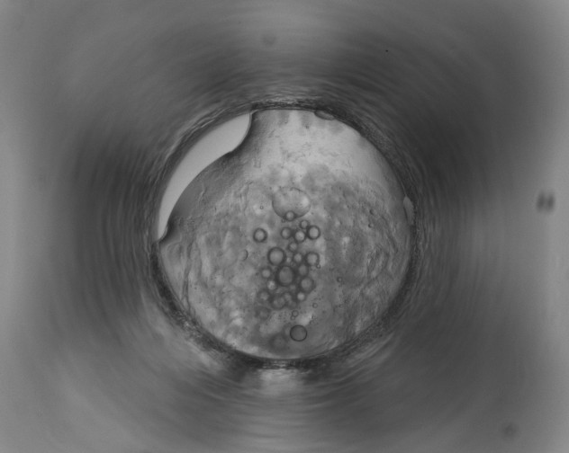 X0000115090216200911171225