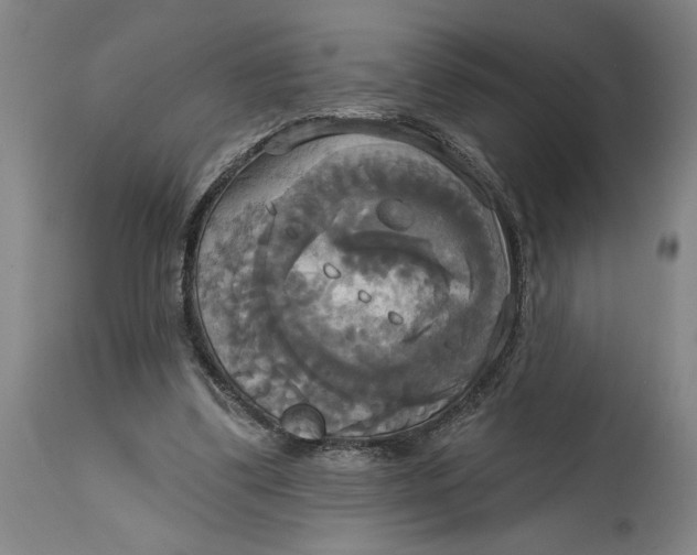 X0000115090299200911171223