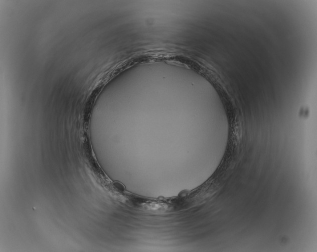 X0000115090512200911171220