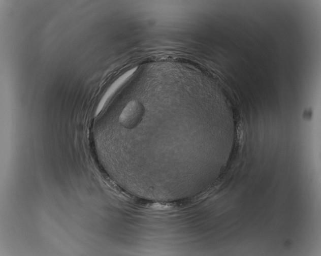 X0000115090570200911171220