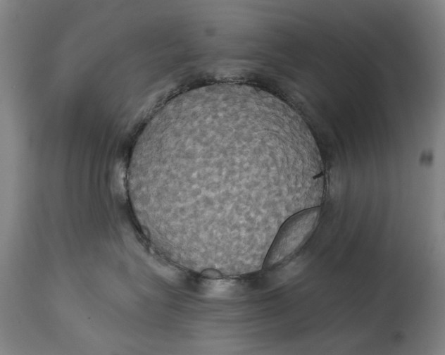 X0000115090575200911171220
