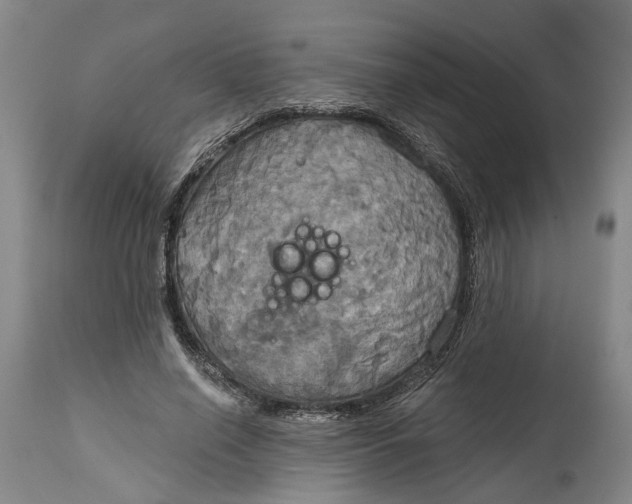 X0000115090638200911171218