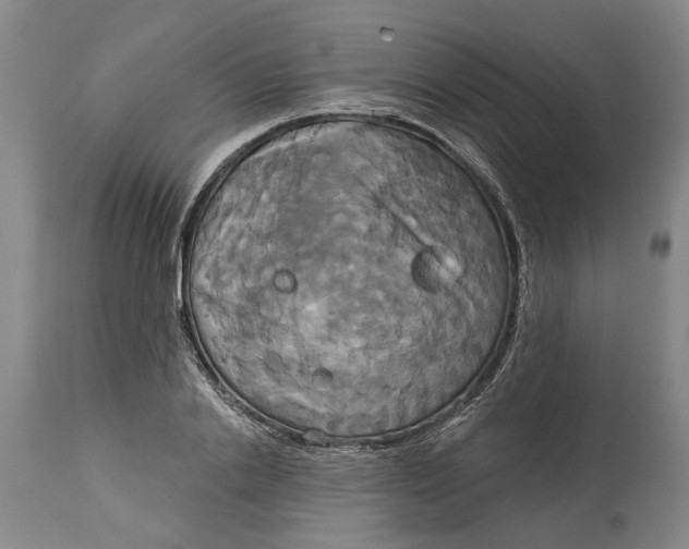 X0000115090838200911171215