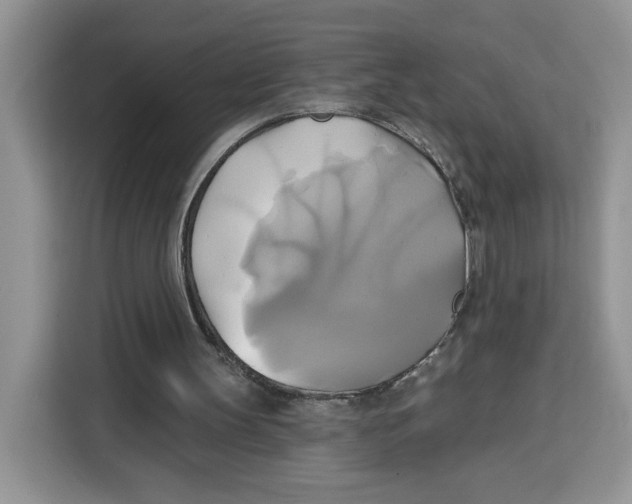 X0000115090147200911241220