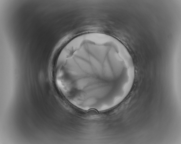 X0000115090149200911241220
