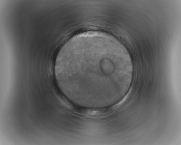 X0000115090174200911241220