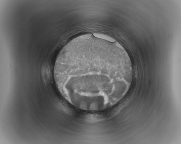 X0000115090408200911241217