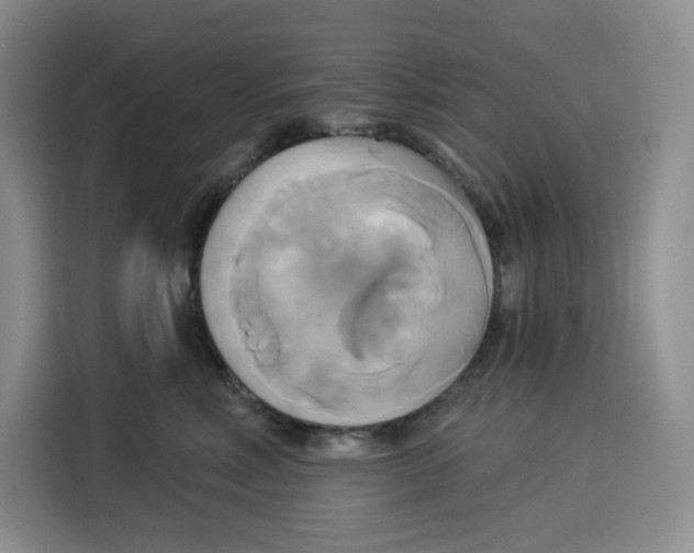 X0000115090618200911241215