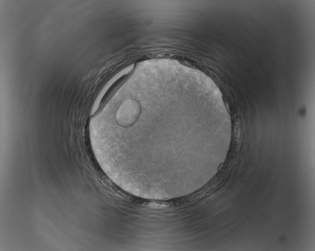 X0000115090570200912081238