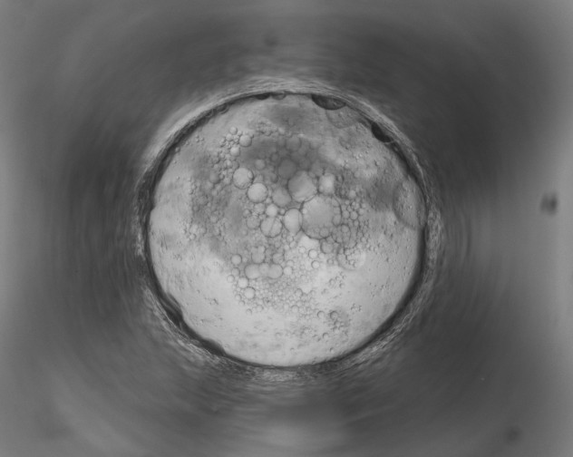X0000115091215200912081227