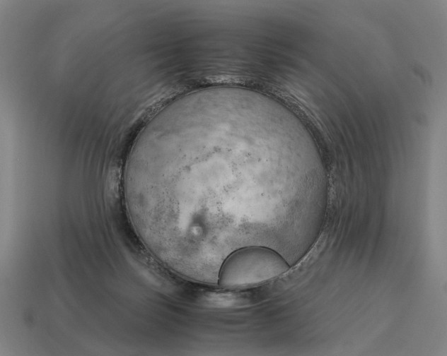 X0000115100171200911101552