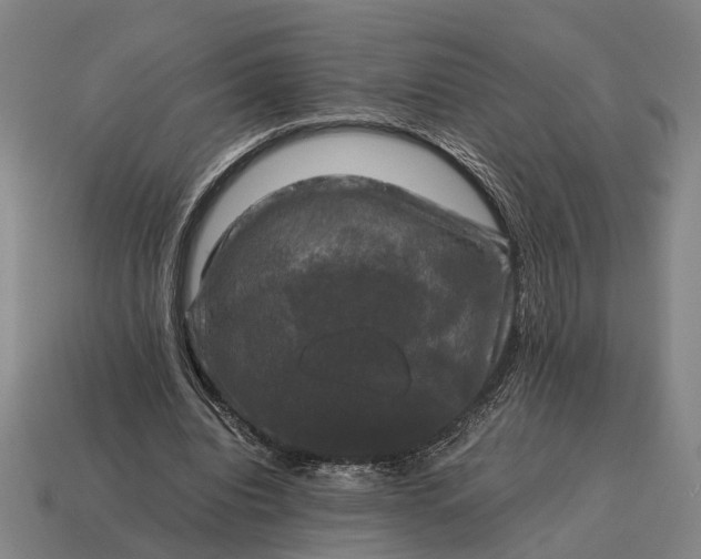X0000115100440200911101548
