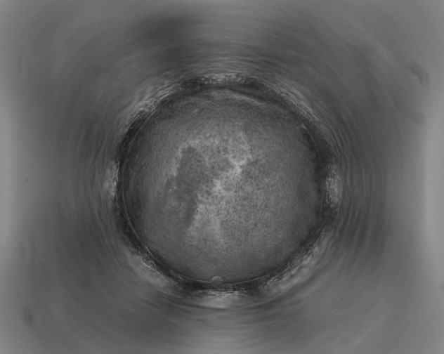 X0000115100458200911101548