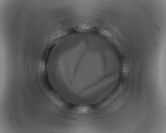 X0000115100711200911101544