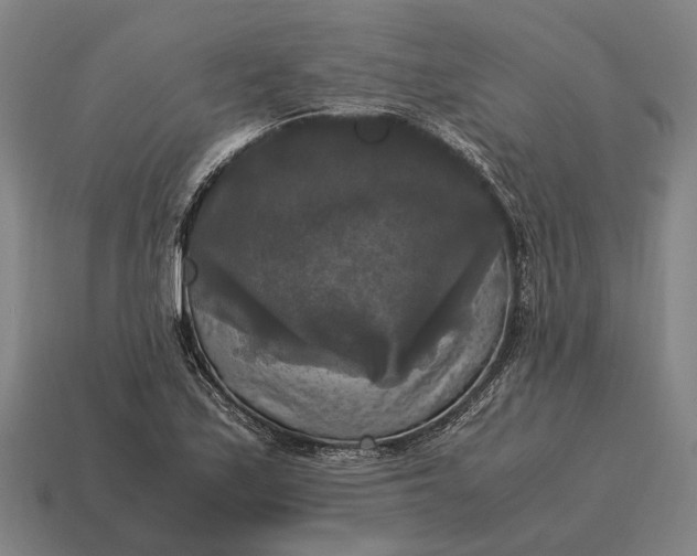 X0000115101171200911101538