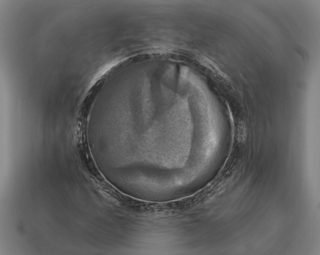 X0000115101208200911101538