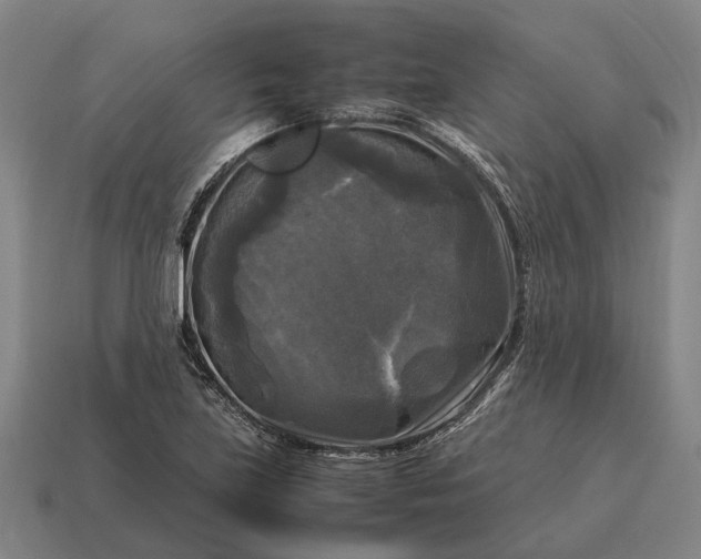 X0000115101219200911101538