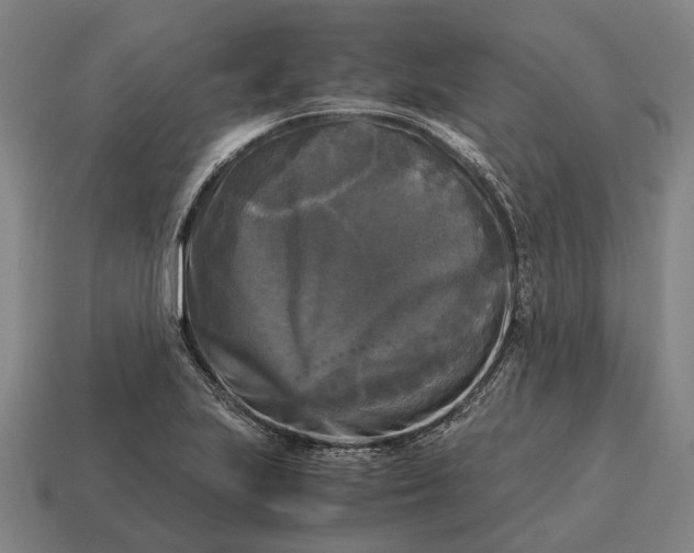 X0000115101223200911101538