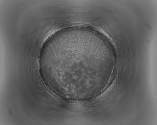 X0000115101259200911101537