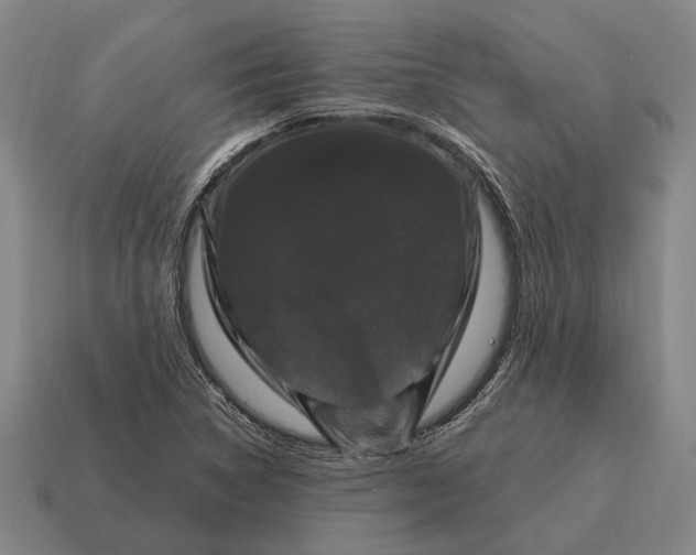 X0000115101314200911101536