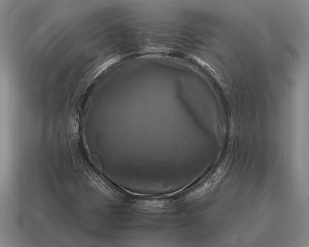 X0000115101401200911101535