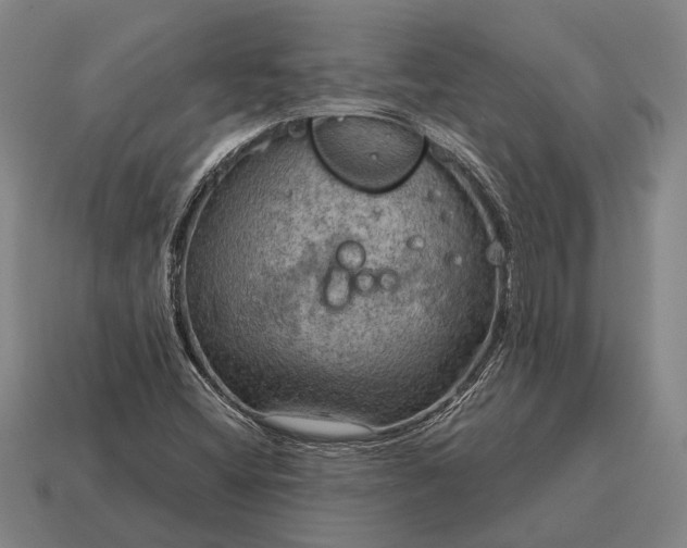 X0000115101404200911101535