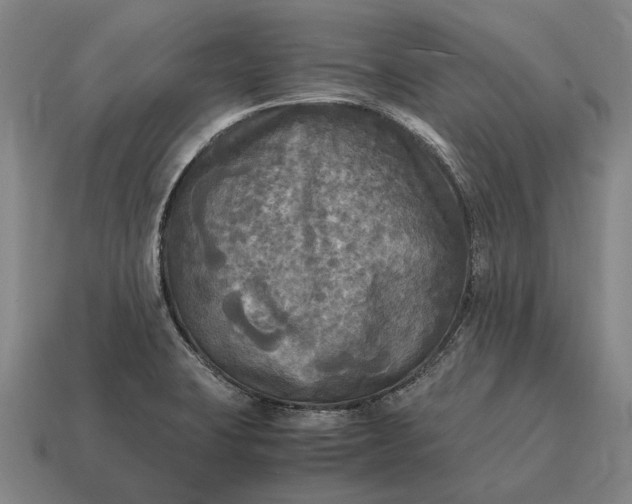 X0000115101423200911101535