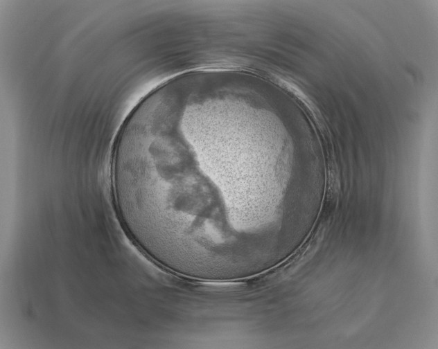X0000115101487200911101534