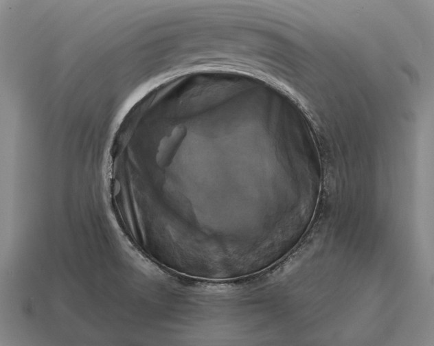 X0000115101522200911101534