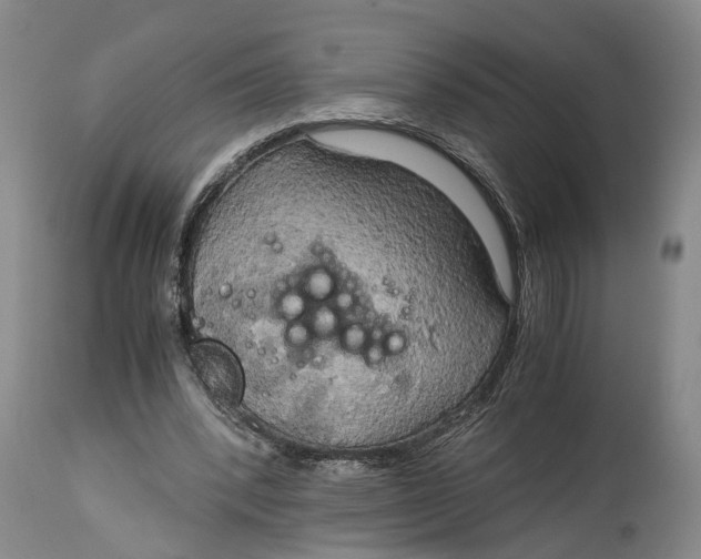 X0000115100392200911171246