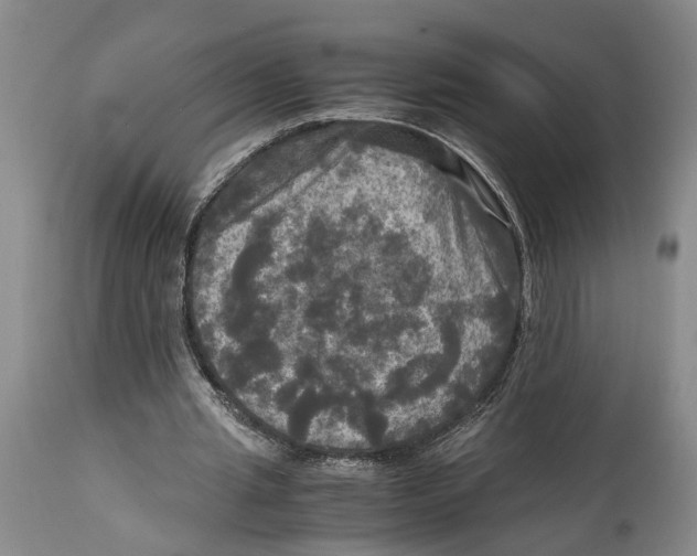 X0000115100437200911171244