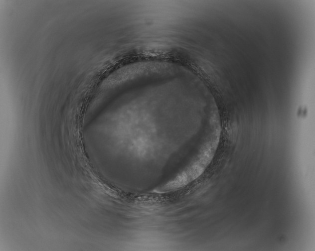 X0000115100817200911171238