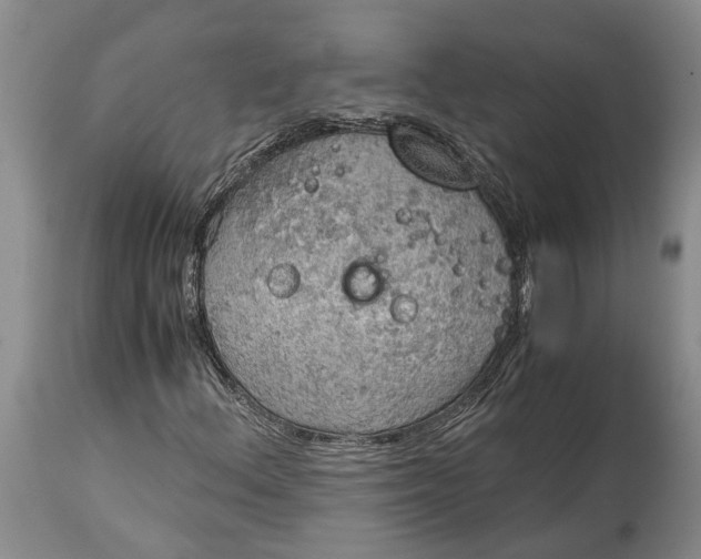 X0000115101156200911171234