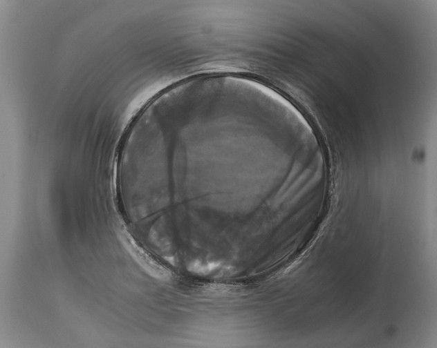 X0000115101179200911171233