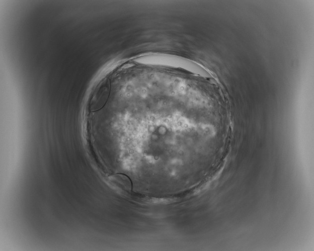 X0000115100149200911241240