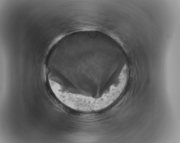 X0000115101171200911241228