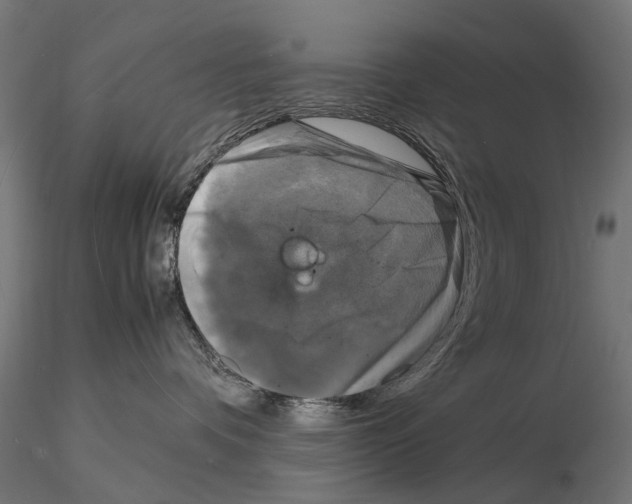 X0000115100336200912081304