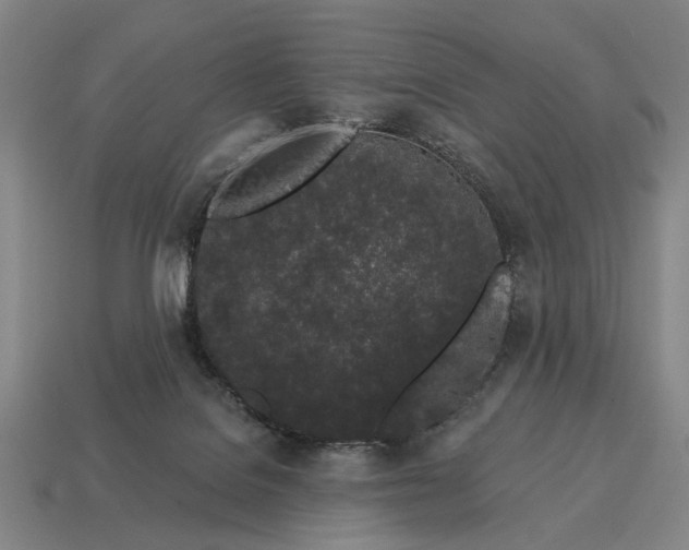 X0000115110076200911101614