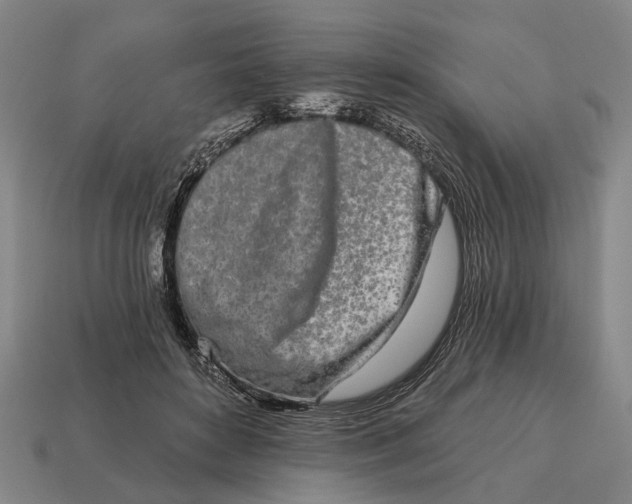 X0000115110504200911101609