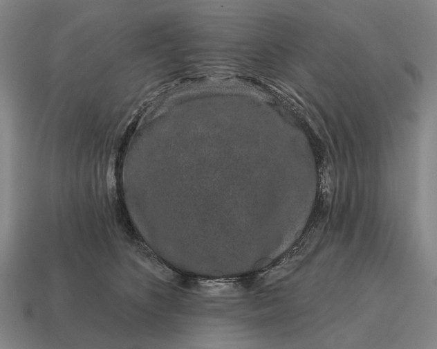 X0000115110516200911101609