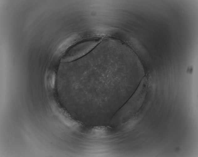 X0000115110076200911171315