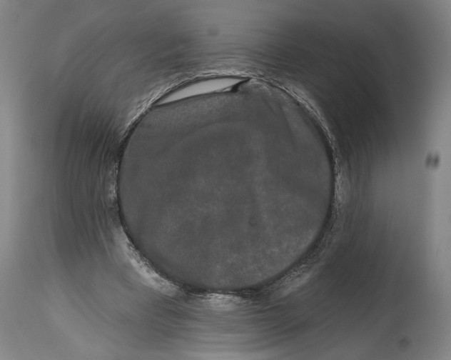X0000115110393200911171310