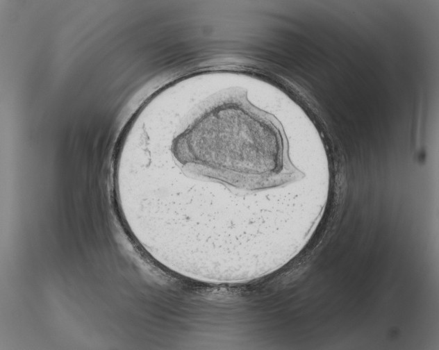 X0000115111418200912081311