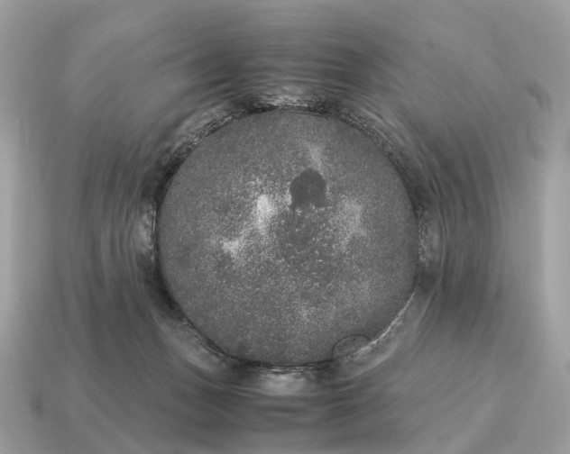 X0000115120175200911101634