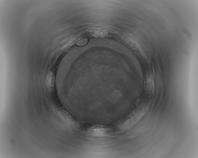 X0000115120228200911101633