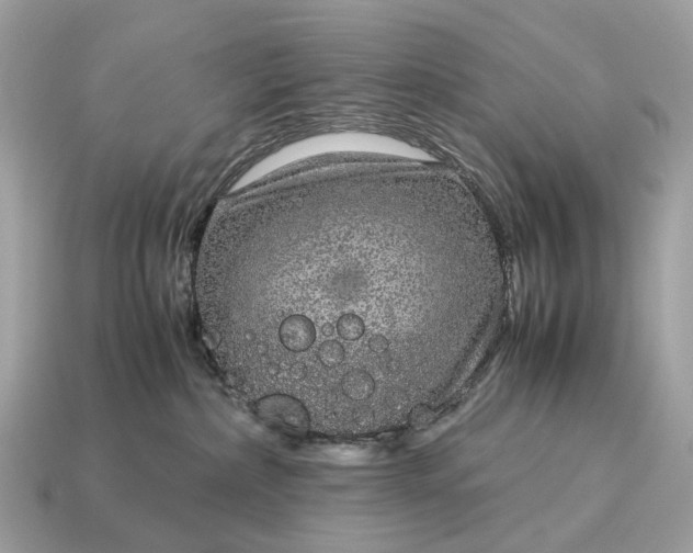 X0000115120236200911101632