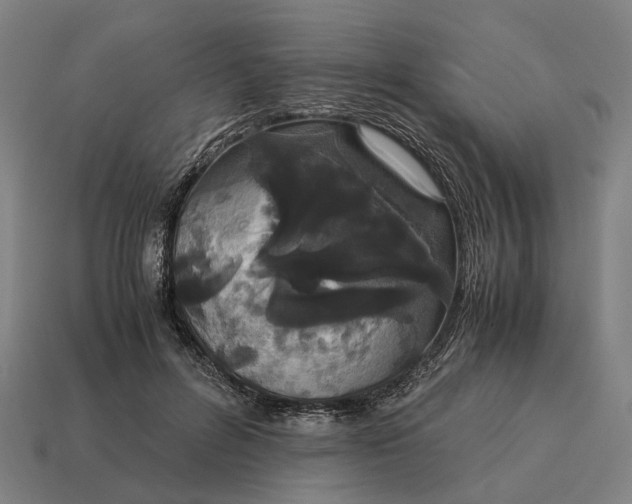 X0000115120600200911101628