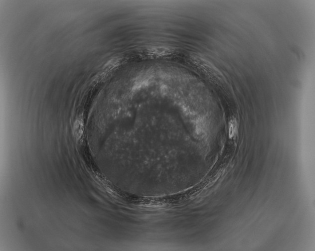 X0000115121011200911101622